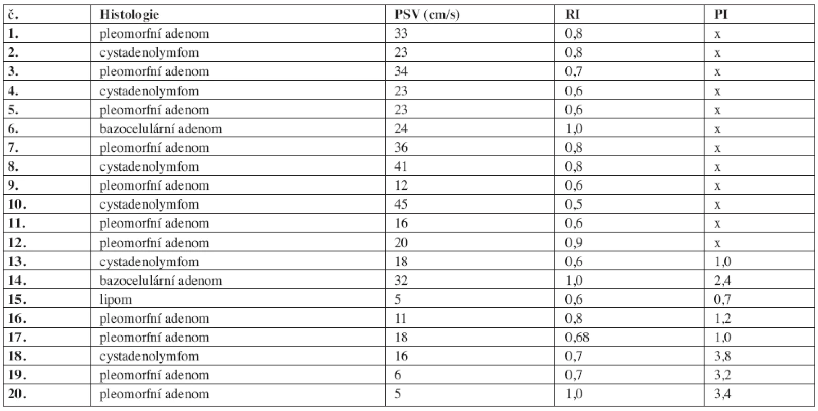 Srovnání výsledků histologického vyšetření benigních nádorů s hodnotami PSV, RI a PI.
