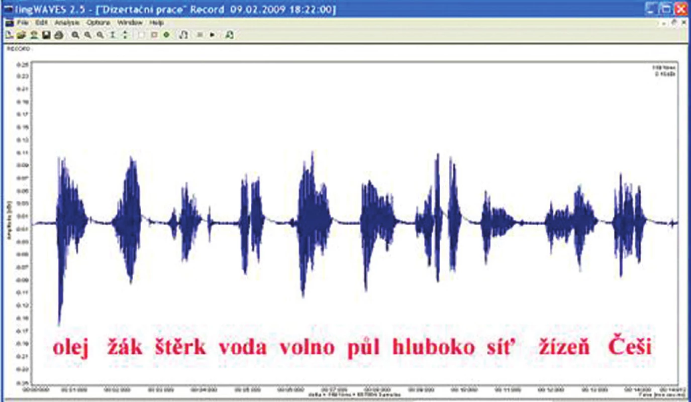 Amplitudový záznam jedné z dekád české slovní audiometrie na pozadí tucha.
Velikost výchylky odpovídá množství akustické energie, kterou nesou jednotlivé hlásky.