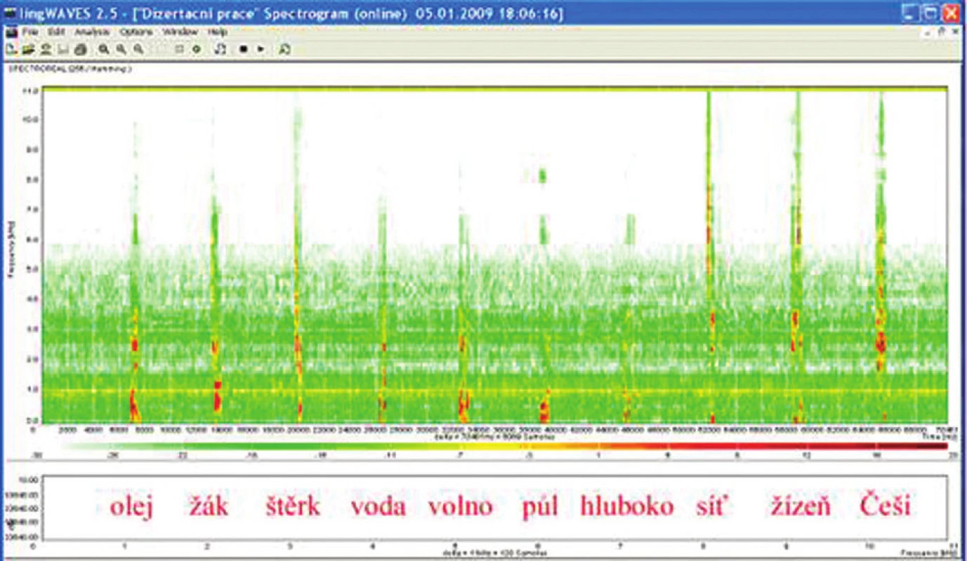 Sonogram slovní audiometrie, dekáda slov, SNR + 10 dB, WN 65 dB.