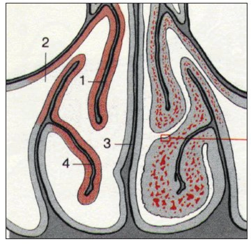 Průřez nosními dutinami ve frontální rovině (podle Beckera).&lt;br&gt;1 – střední skořepa, 2 – vyvod čelistní dutiny, 3 – nosní přepážka, 4 – dolní skořepa, vlevo jsou cévy rozšířené – nazální cyklus.