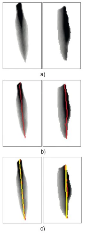 Snímky odpovídající krokům odhadu osy symetrie pro případ symetrického
a nesymetrického chování hlasivek:
