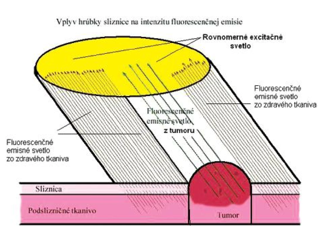Vplyv hrúbky epitelu na vznik fluorescenčného emisného svetla (upravené podľa 6).
