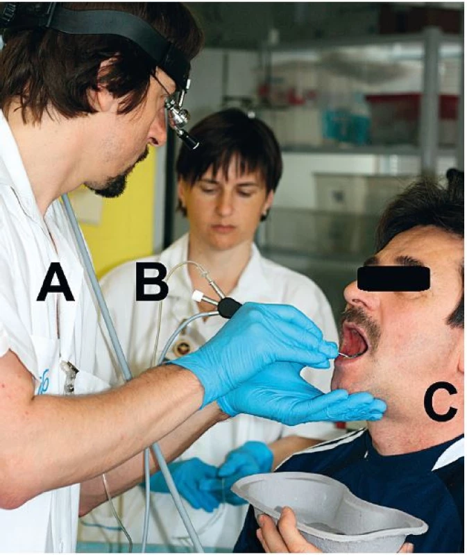 Postavení operačního týmu při sialoendoskopii (A – operatér sleduje endoskopický obraz na monitoru, B – asistent provádí během výkonu proplach vývodu žlázy fyziologickým roztokem, C – pacient s otokem podčelistní žlázy vlevo).