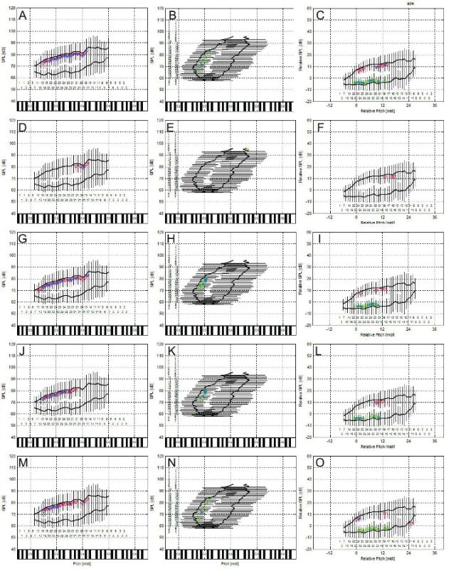 Korelace percepčních hodnocení s obrysovými křivkami celkového (zpěvního) hlasového pole: A-C) celkový stupeň poruchy hlasu, D-F) chraplavost, G-I) dyšnost, J-K) astenie – hlasová slabost, M-O) napětí hlasu. Absolutní SPL kontury (levý sloupec), absolutní výškové kontury (střední sloupec), C2-C6 odpovídají americké notaci velké C až c´´´. Normalizované SPL kontury (pravý sloupec) vzhledem k průměrné výšce (uvedeno v půltónech) a SPL habituálního hlasu.