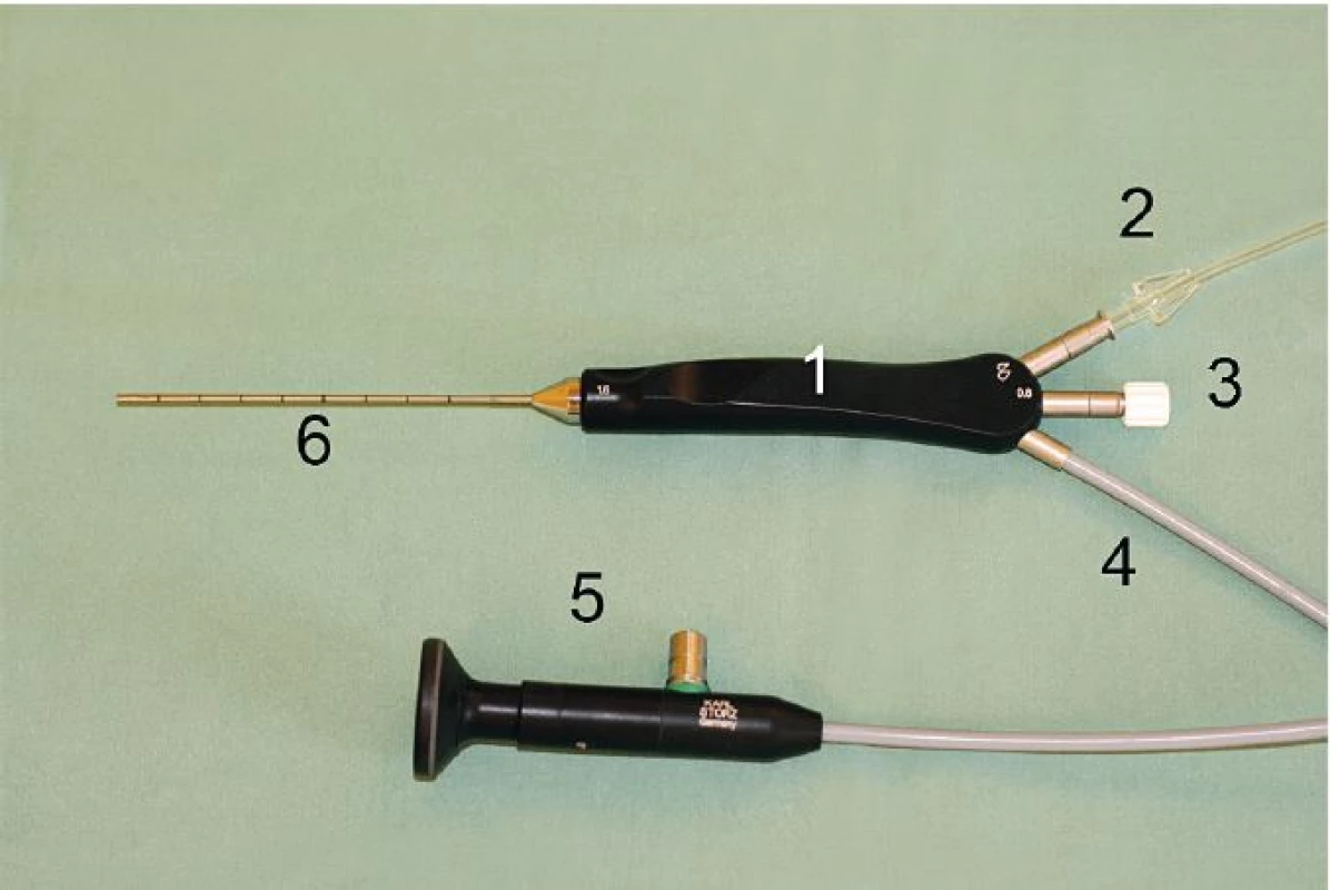 Semirigidní endoskop firmy K. Storz 1,6 mm (1 – tělo endoskopu, 2 – irigační kanál, 3 – pracovní kanál, 4 – světelný kanál, 5 – koncovka k připojení kamery a zdroje světla, 6 – pracovní koncovka endoskopu).