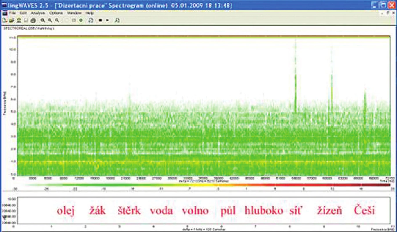 Sonogram slovní audiometrie, dekáda slov, SNR – 10 dB, WN 65 dB.
