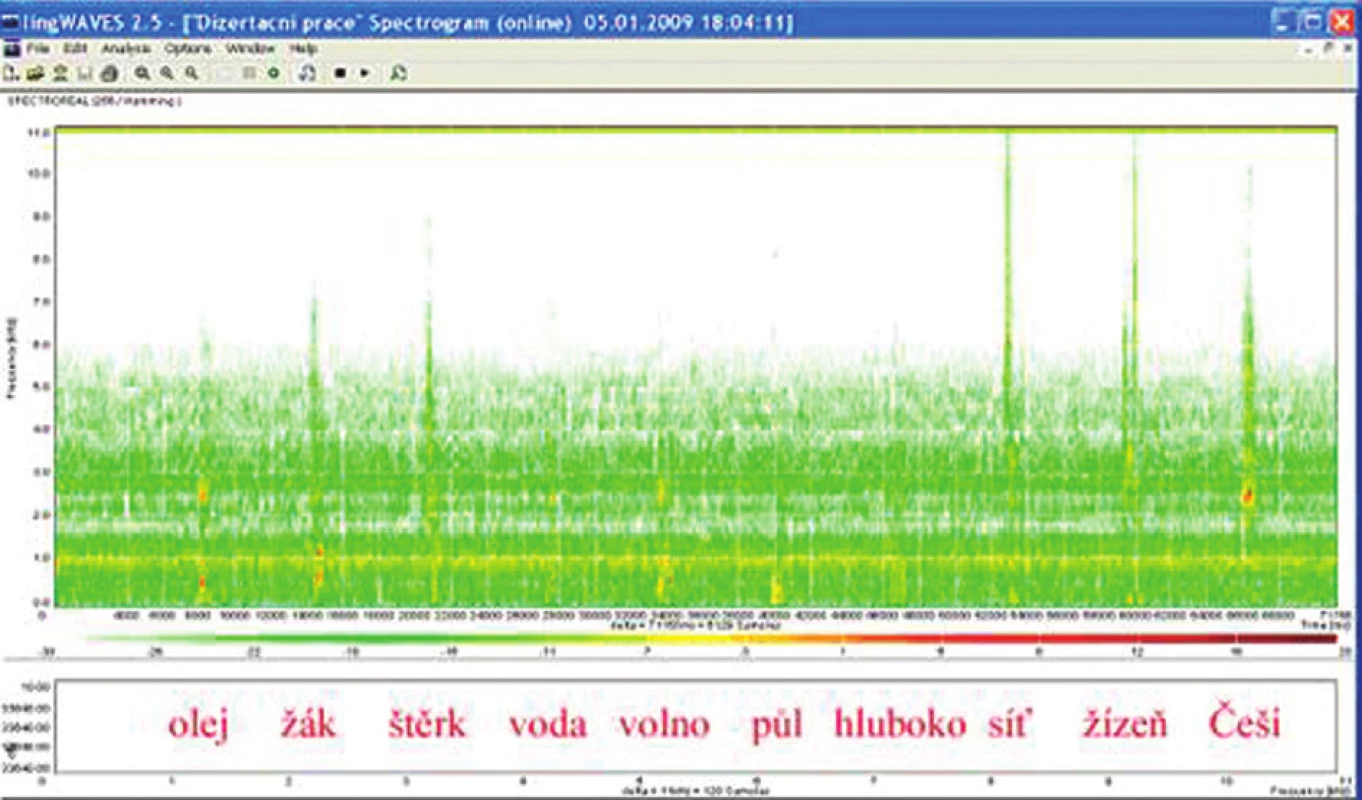 Sonogram slovní audiometrie, dekáda slov, SNR - 0 dB, WN dB.