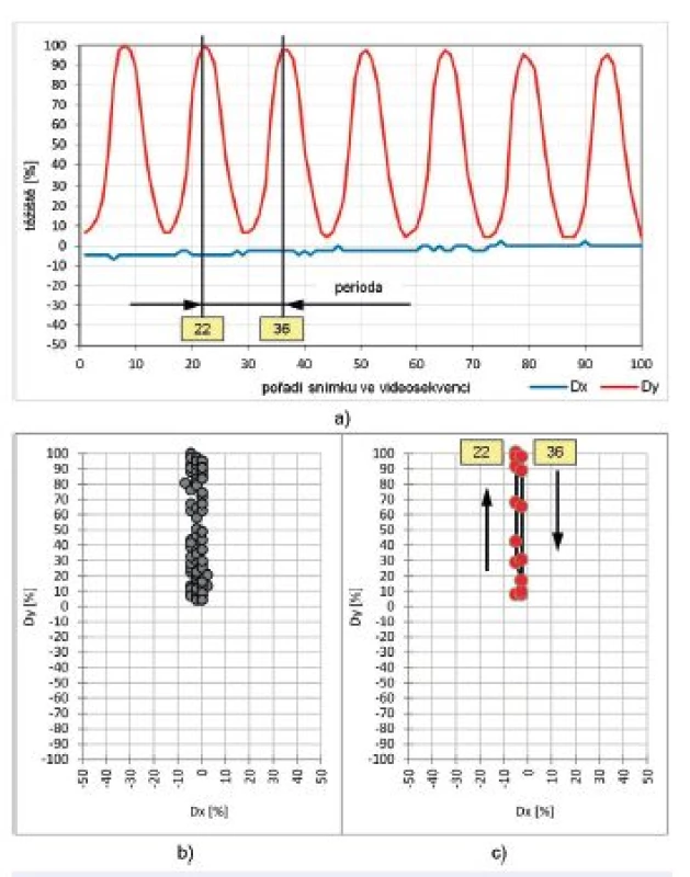 Vývoj polohy těžiště Dx a Dy hlasivkové štěrbiny u zdravého jedince – (žena, SPL = 92 dB, F<sub>o</sub> = 252 Hz):
