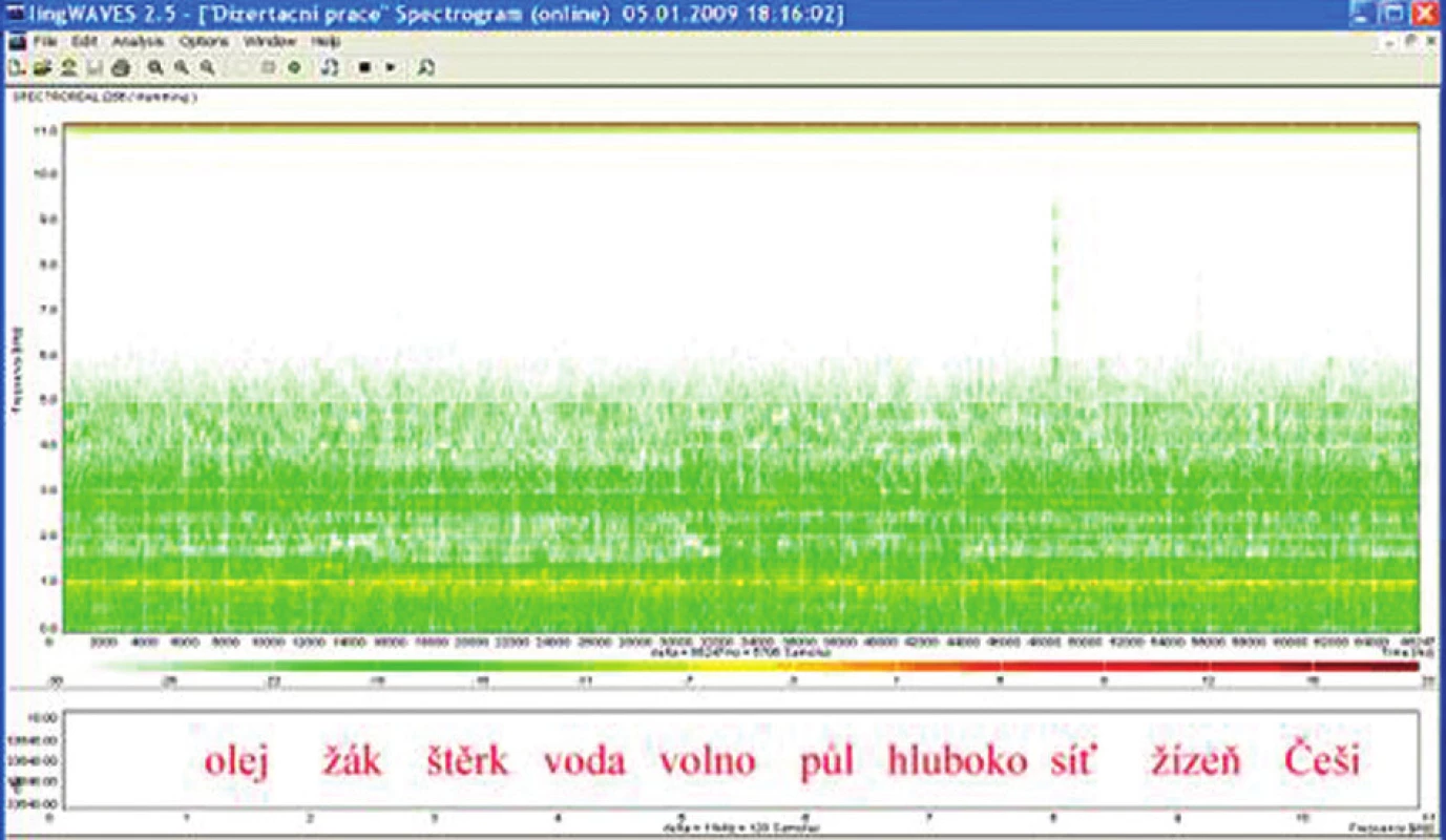 Sonogram slovní audiometrie, dekáda slov, SNR – 20 dB, WN 65 dB.